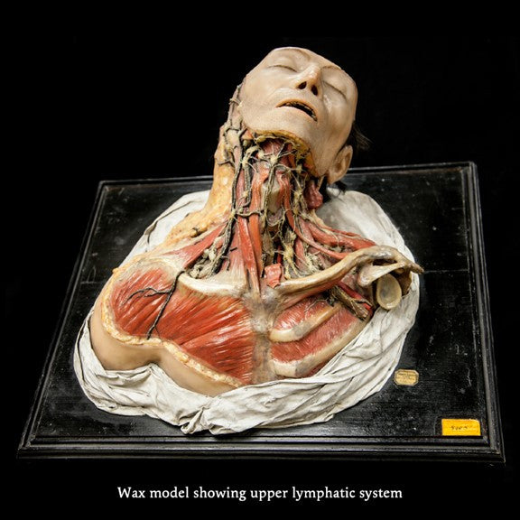 Highlights from the Mütter Museum of The College of Physicians of Philadelphia