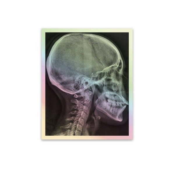 Holographic Xray Decal Pack