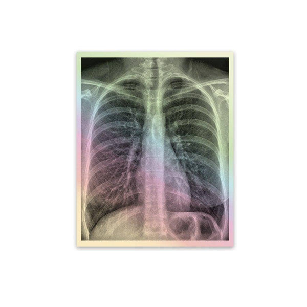 Holographic Xray Decal Pack