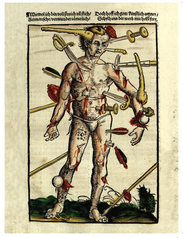 Wound Man Notecard