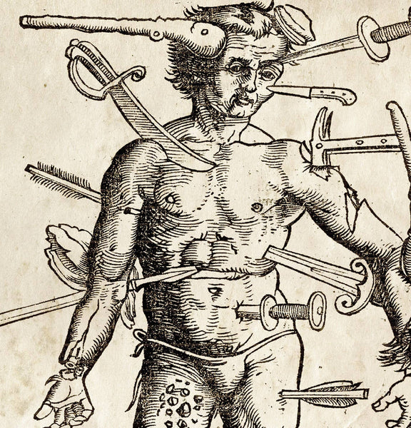 8x10 Vintage Anatomy Wounded Man Print