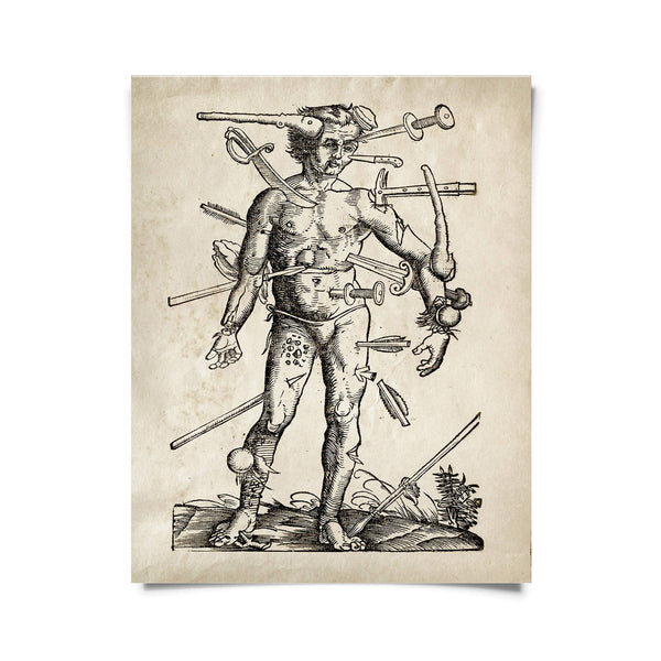 8x10 Vintage Anatomy Wounded Man Print