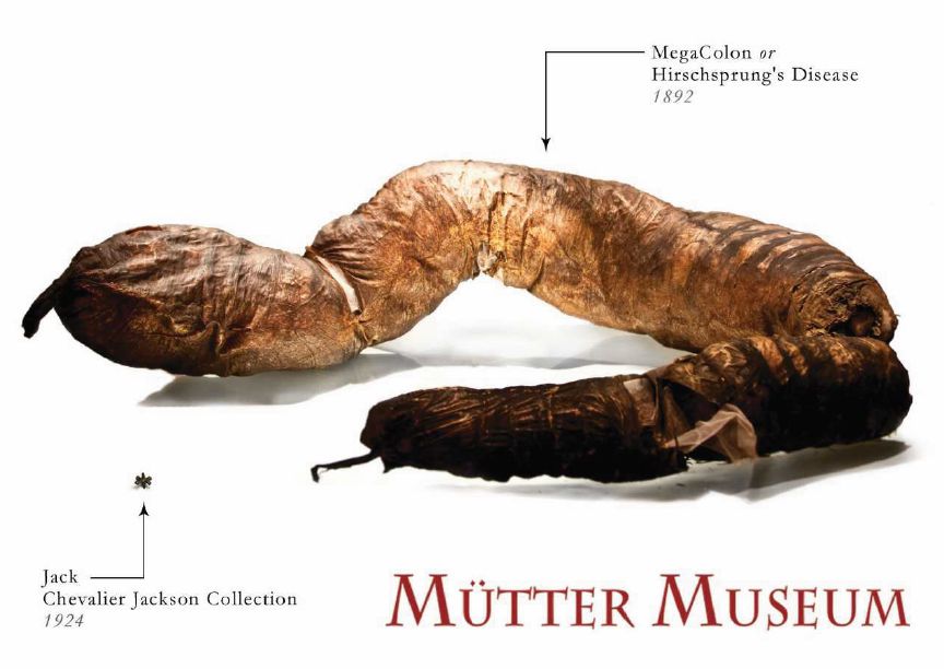 A white background with a photo of the megacolon and a photo of a jack on it for size comparison. The Mütter Museum logo in maroon is on the bottom.