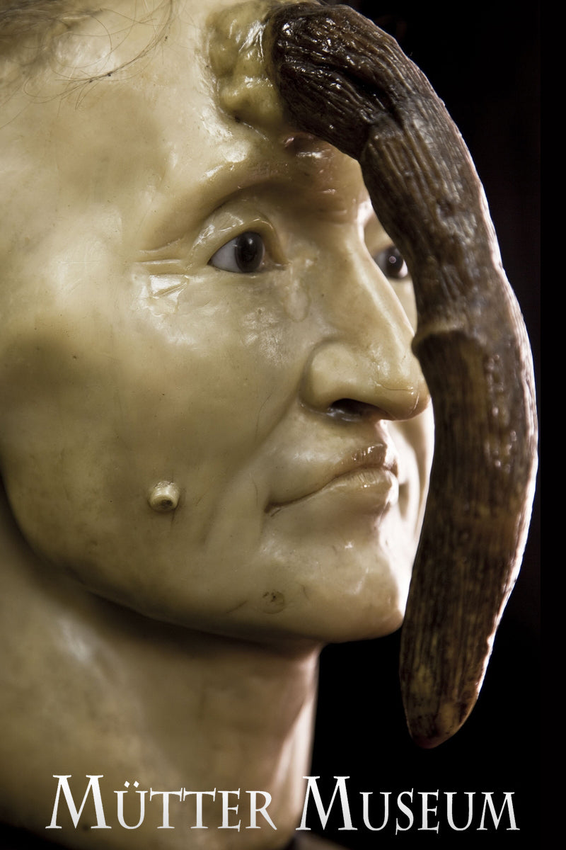 A photo of a wax model of Madame Dimanche, a woman with a keratin horn growing out of her forehead. The Mütter Museum logo is in white on the bottom.
